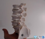 Rachis lombaire par impression 3D — issu d'une TDM